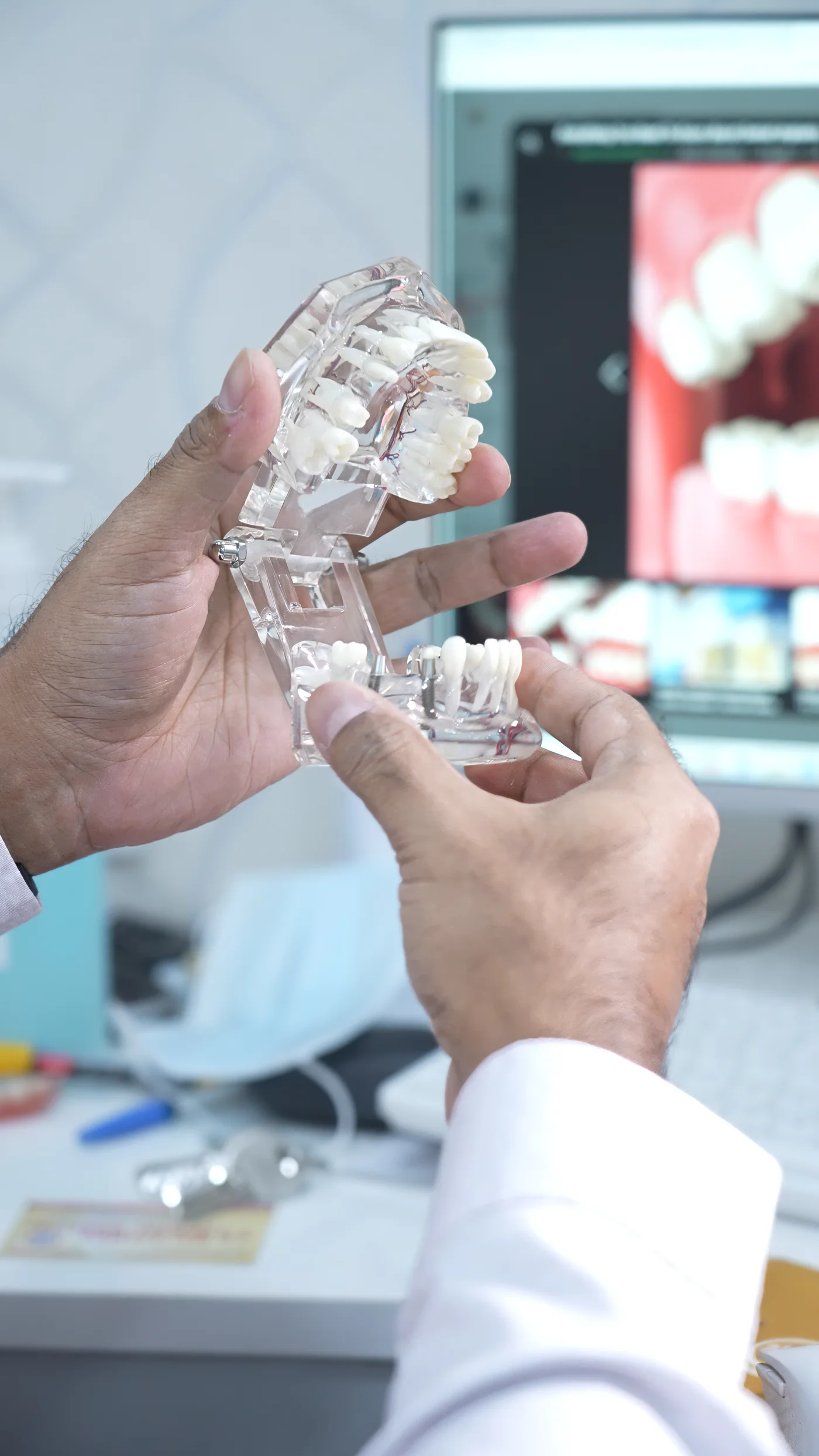 Implant consultation